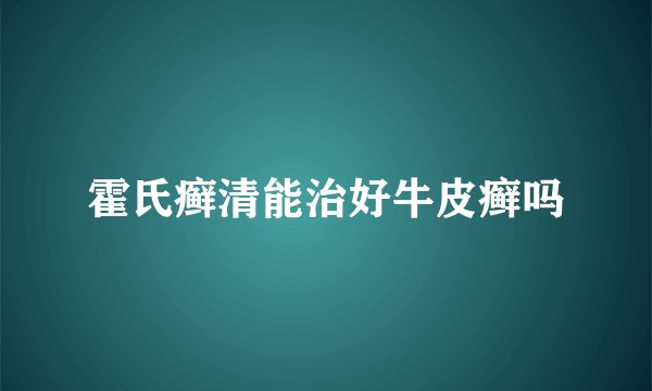 霍氏癣清能治好牛皮癣吗