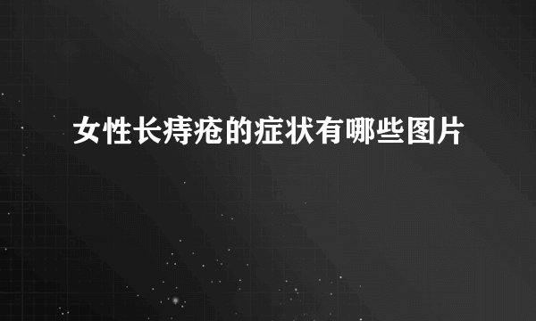 女性长痔疮的症状有哪些图片