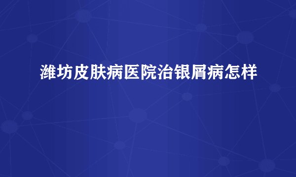 潍坊皮肤病医院治银屑病怎样