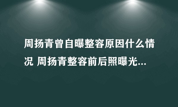 周扬青曾自曝整容原因什么情况 周扬青整容前后照曝光令人震惊