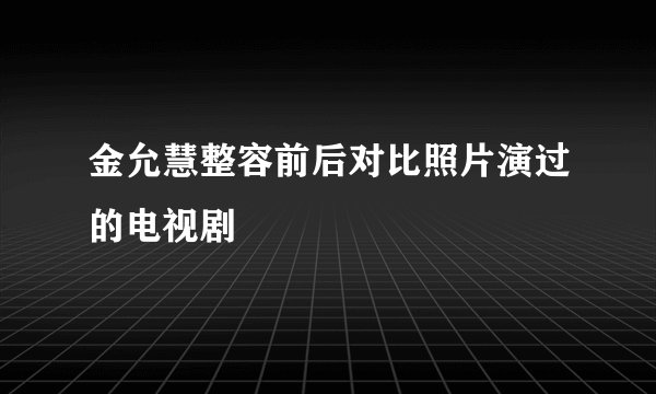 金允慧整容前后对比照片演过的电视剧
