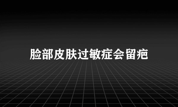 脸部皮肤过敏症会留疤