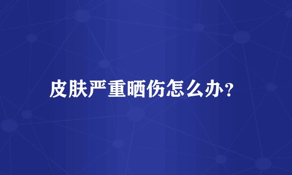 皮肤严重晒伤怎么办？