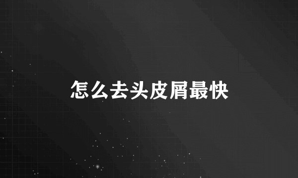 怎么去头皮屑最快