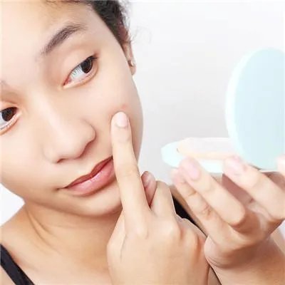 最好的治疗青春痘的医院在哪里?