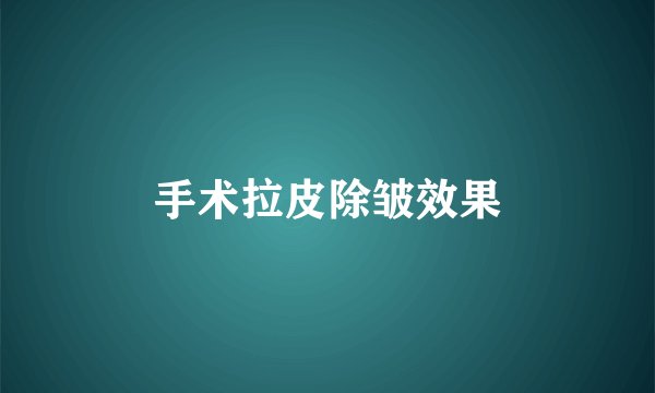手术拉皮除皱效果
