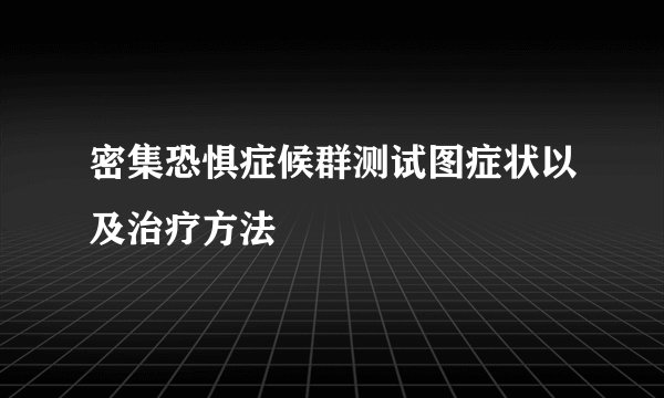 密集恐惧症候群测试图症状以及治疗方法