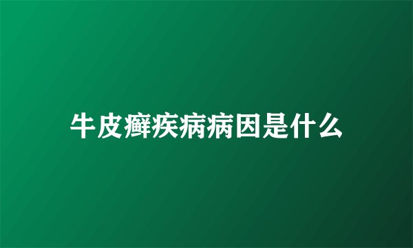 牛皮癣疾病病因是什么