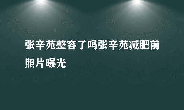 张辛苑整容了吗张辛苑减肥前照片曝光