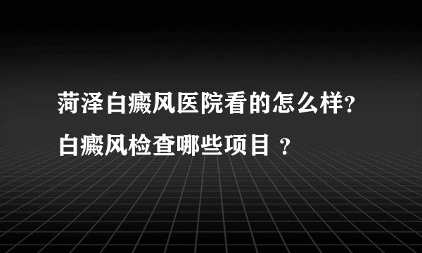 菏泽白癜风医院看的怎么样？白癜风检查哪些项目 ？