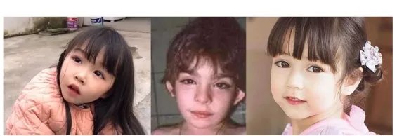 长得太漂亮也是病?歌舞伎面谱综合征,一种美得像洋娃娃的遗传病