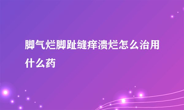 脚气烂脚趾缝痒溃烂怎么治用什么药