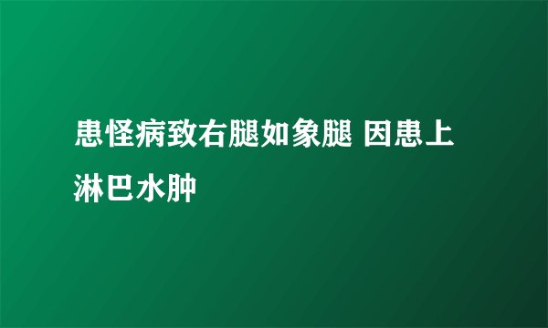 患怪病致右腿如象腿 因患上淋巴水肿