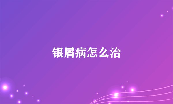 银屑病怎么治