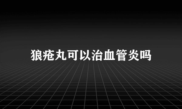 狼疮丸可以治血管炎吗