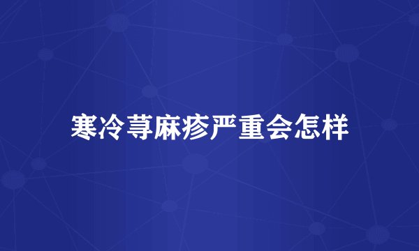 寒冷荨麻疹严重会怎样