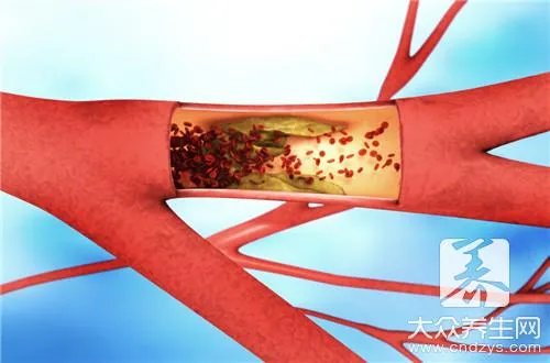 纳豆胶囊怎么吃