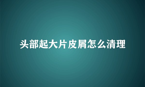 头部起大片皮屑怎么清理
