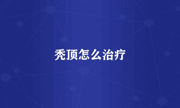 秃顶怎么治疗