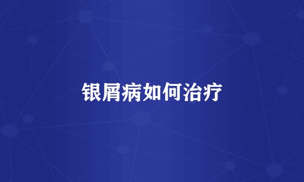 银屑病如何治疗