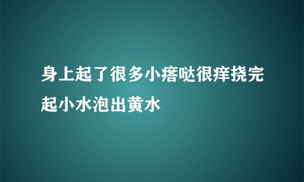身上起了很多小瘩哒很痒挠完起小水泡出黄水