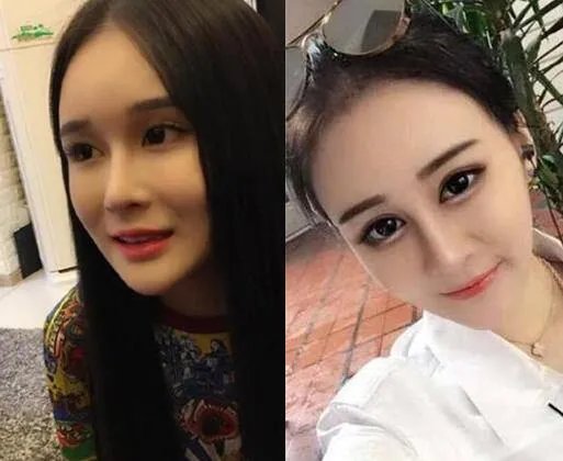 赵本山女儿斥喷子太闲  被质疑整成网红脸