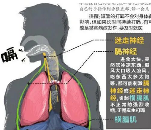 世界上打嗝时间最长的人,美国农夫打嗝长达68年(每天打嗝24000次)