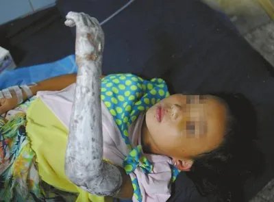 火灾5楼抛出儿女孩子妈妈受伤没？
