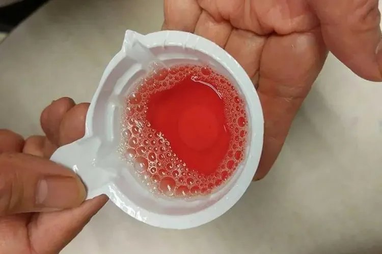 小便图片对比图