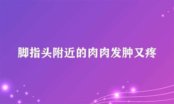 脚指头附近的肉肉发肿又疼