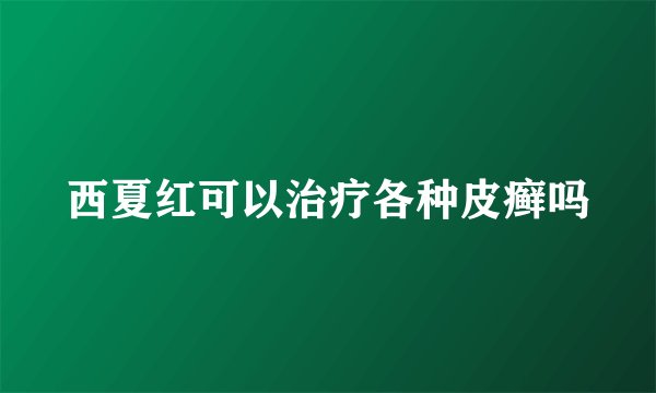 西夏红可以治疗各种皮癣吗