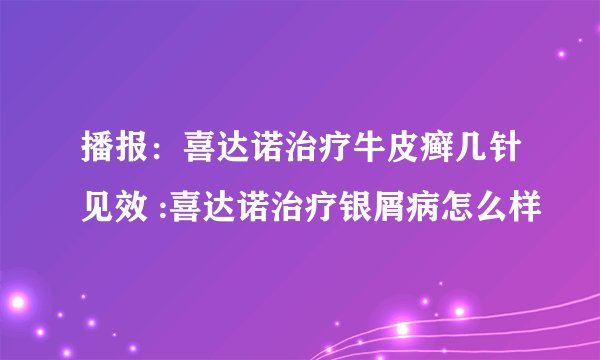 播报:喜达诺治疗牛皮癣几针见效 :喜达诺治疗银屑病怎么样