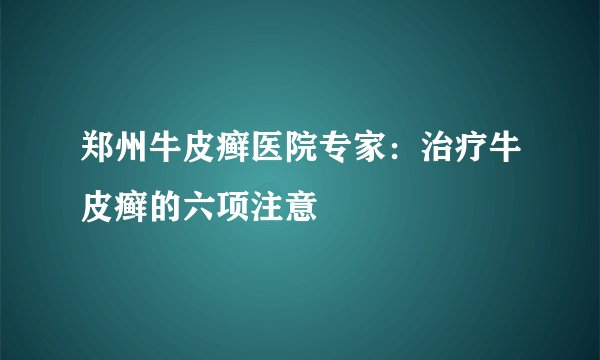 郑州牛皮癣医院专家：治疗牛皮癣的六项注意