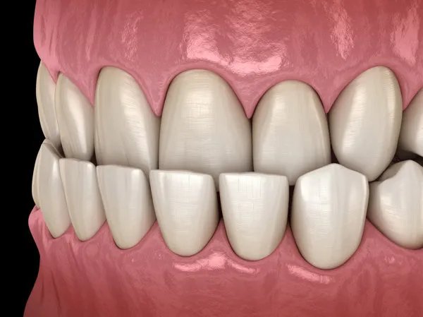 美白牙齿有几种方法