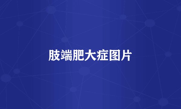 肢端肥大症图片