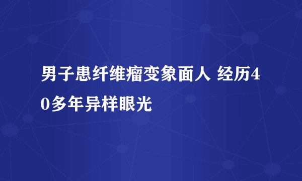 男子患纤维瘤变象面人 经历40多年异样眼光