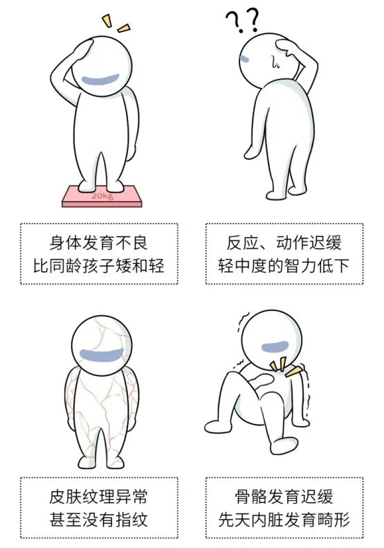 长得太漂亮也是病?歌舞伎面谱综合征,一种美得像洋娃娃的遗传病