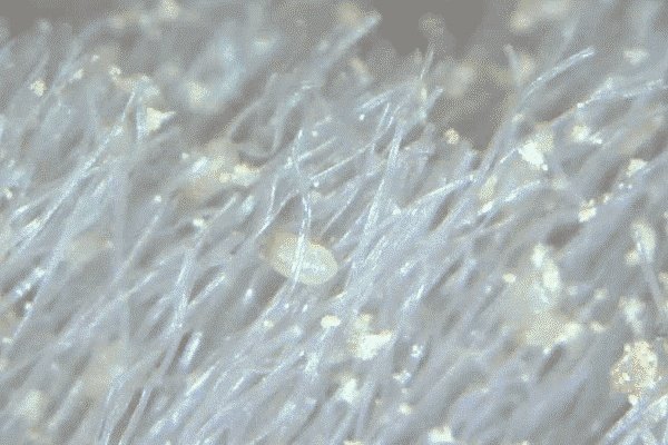 一个枕头=亿万螨虫,不用拆不用洗,一招快速杀死所有螨虫!