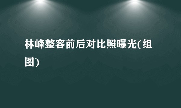 林峰整容前后对比照曝光(组图)