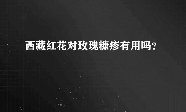 西藏红花对玫瑰糠疹有用吗？