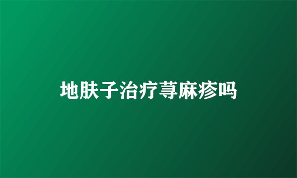 地肤子治疗荨麻疹吗
