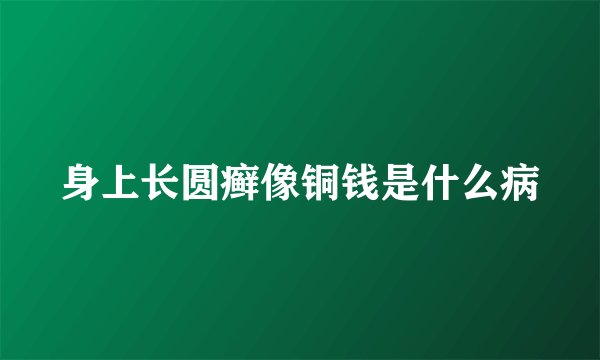 身上长圆癣像铜钱是什么病