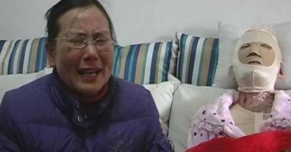 16岁少女曾因拒绝官二代追求,被其泼硫酸毁容,如今过得怎么样?