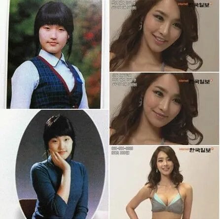 韩国女星金宥利整容前后对比 韩国小姐到底有没有整容？