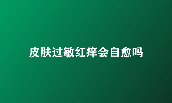 皮肤过敏红痒会自愈吗