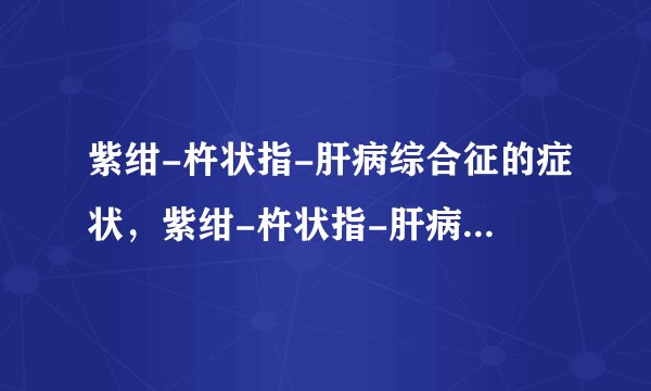 紫绀-杵状指-肝病综合征的症状,紫绀-杵状指-肝病综合征的早期症状,并发症