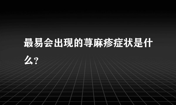 最易会出现的荨麻疹症状是什么?