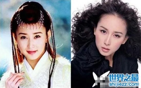 胡静整容前后照片，腮帮子都削没了/脸部僵硬的可怕 
