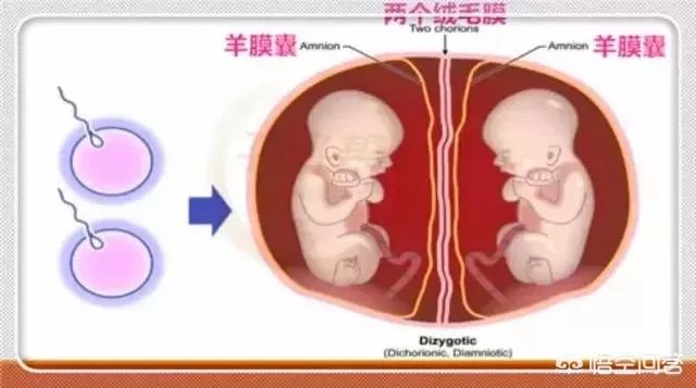 怀了双胞胎，他们会在妈妈肚子里打架吗？