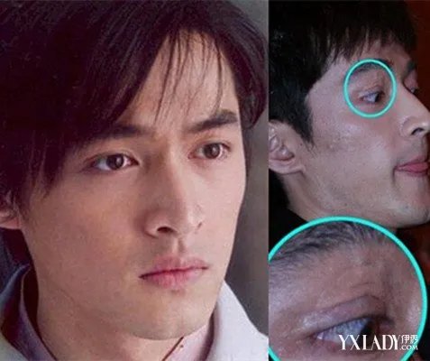 胡歌车祸前后对比照揭秘车祸诡异内幕